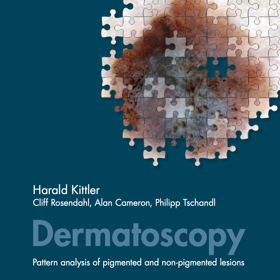 Dermatoscopy book cover