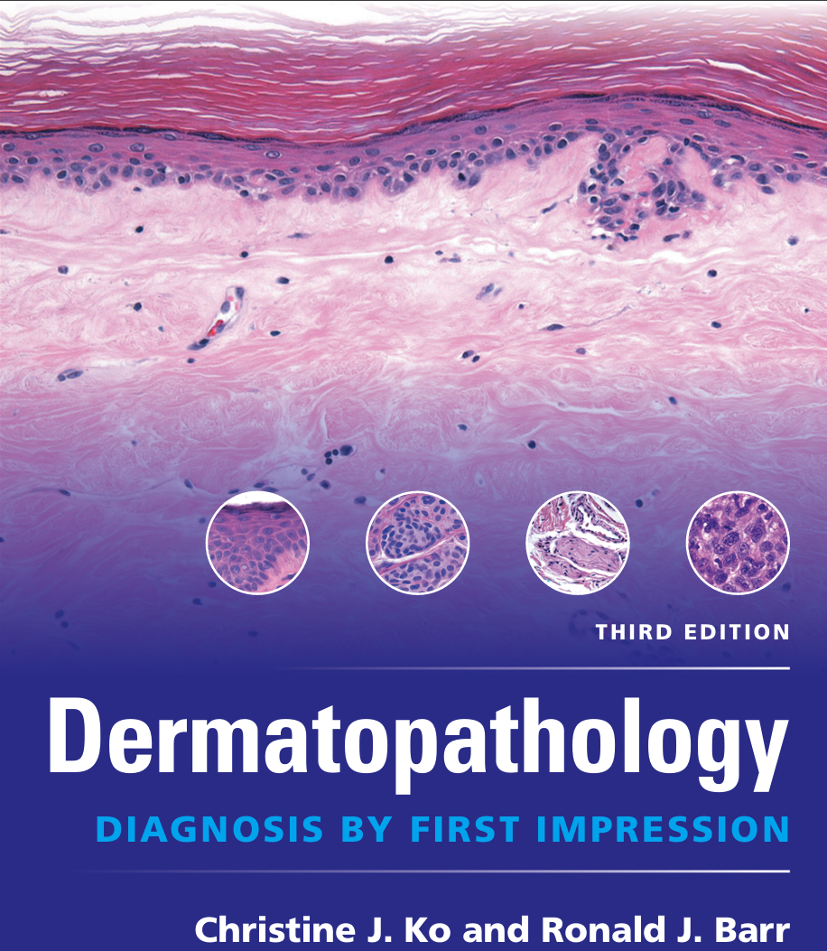 Dermatopathology Diagnosis by First Impression